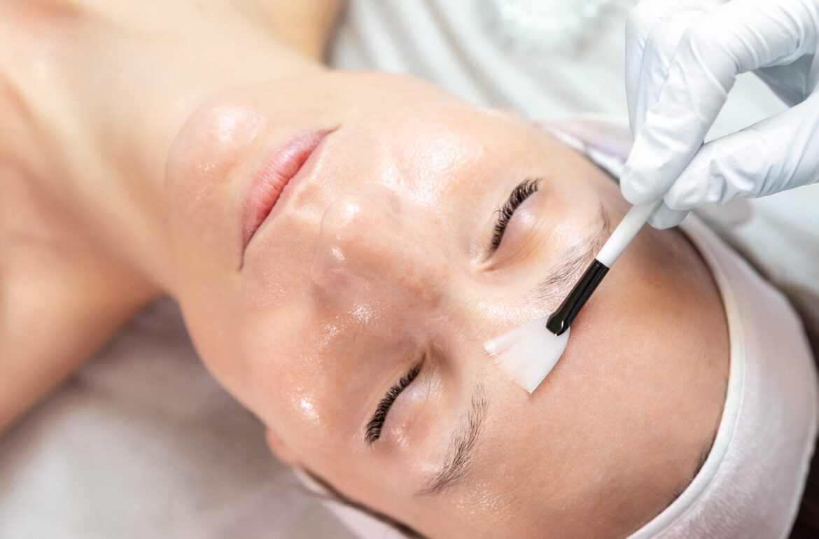 What To Expect With A Chemical Peel