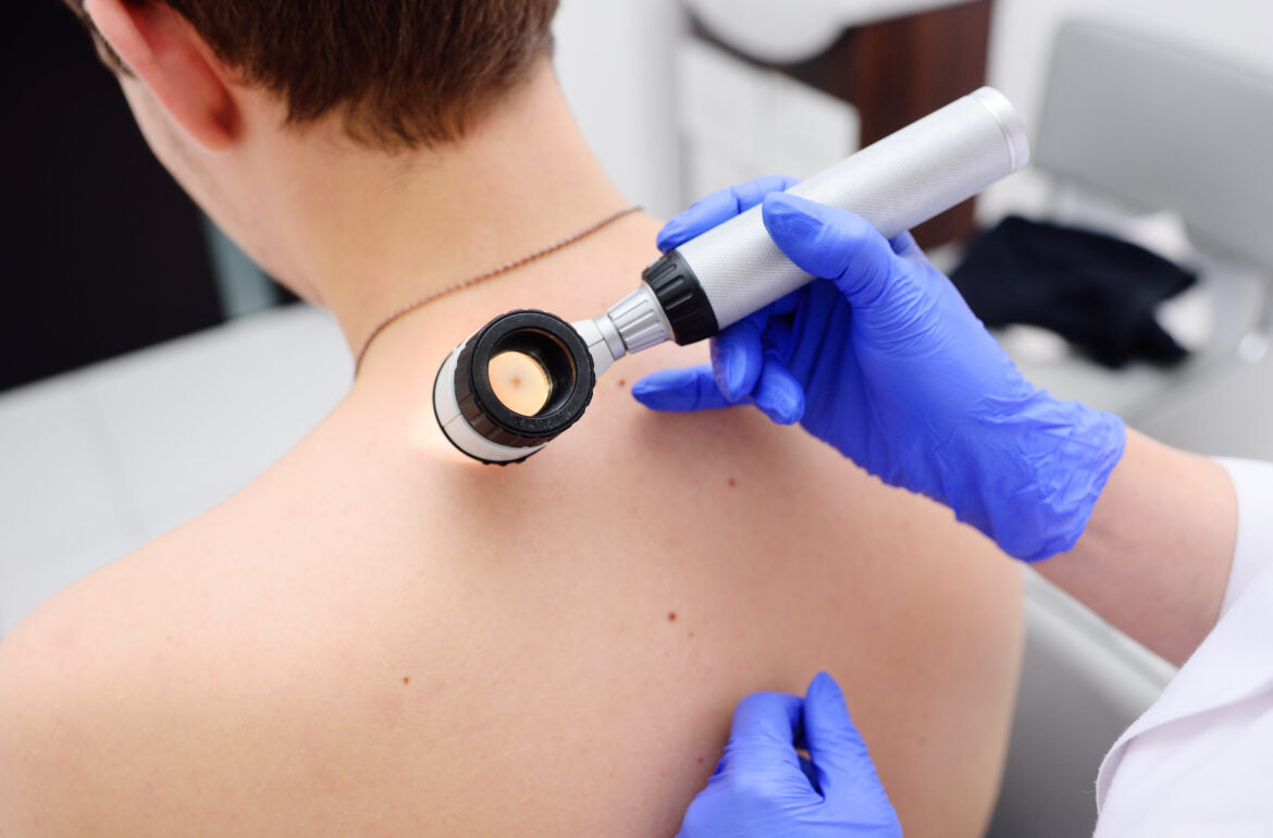 3 Common Dermatology Procedures