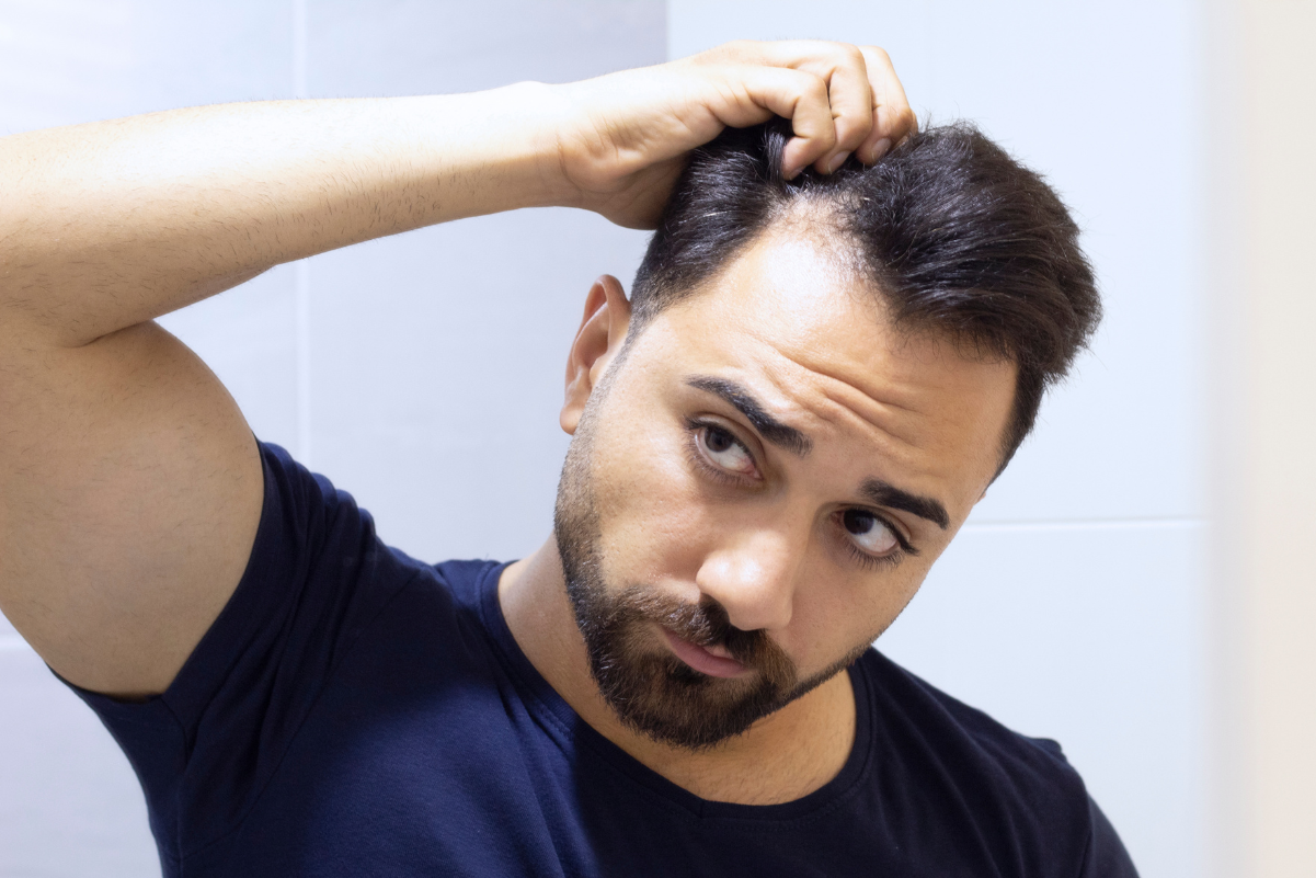 Why is my hair thinning? Signs, Common Causes and Top Treatments