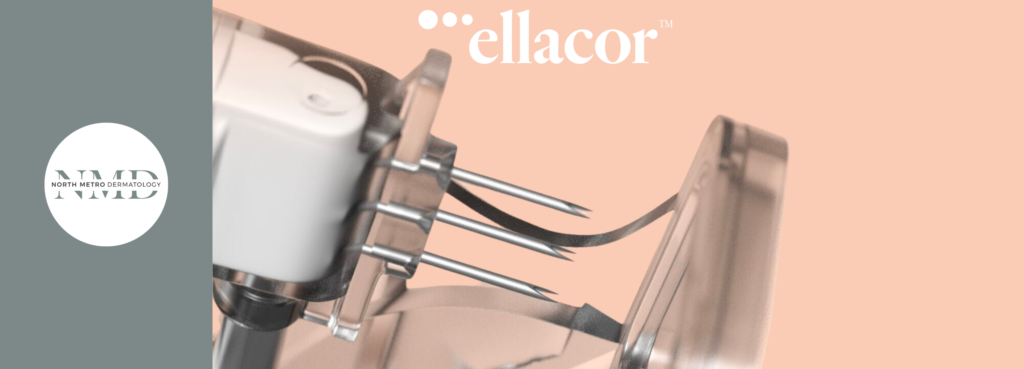 ELLACOR® - A FIRST-OF-ITS-KIND TREATMENT FOR WRINKLES AND LAXITY